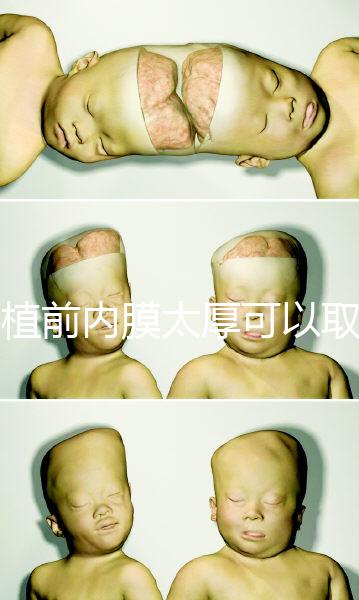 移植前內膜太厚可以取卵早知道，疼痛因人而異