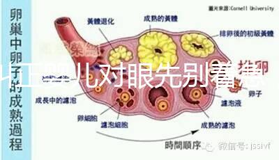糾正嬰兒對眼先別著急，眼科醫生教你3招鑒別法