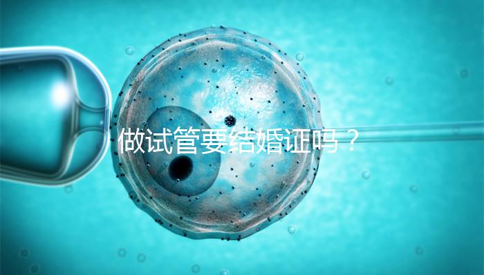 做試管要結婚證嗎？