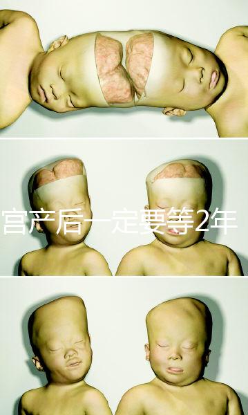 剖宮產(chǎn)后一定要等2年，才能試管嬰兒懷孕嗎？