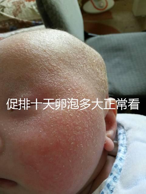 促排十天卵泡多大正常看這，1.1×0.9符不符合一文說(shuō)清