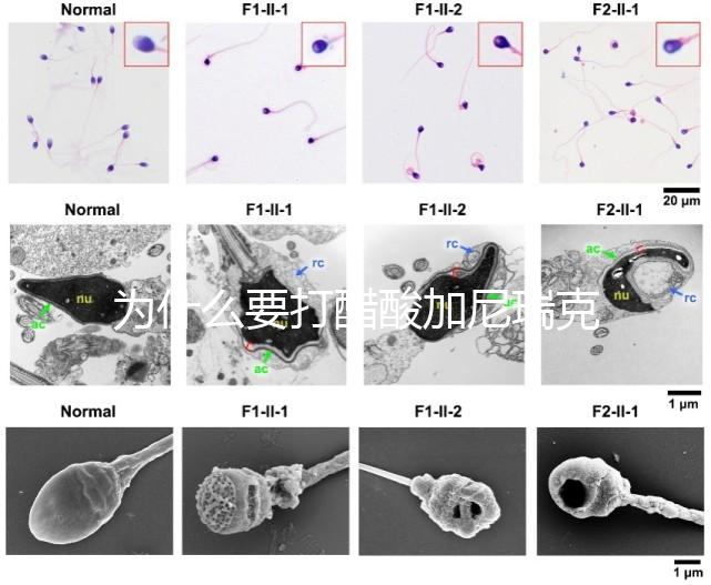 為什么要打醋酸加尼瑞克?試管拮抗劑方案的“穩定劑”