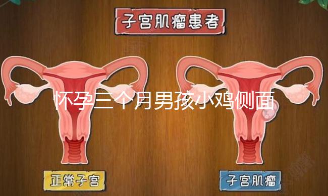 懷孕三個(gè)月男孩小雞側(cè)面二維b超圖片分享，原來兩腿間有尖