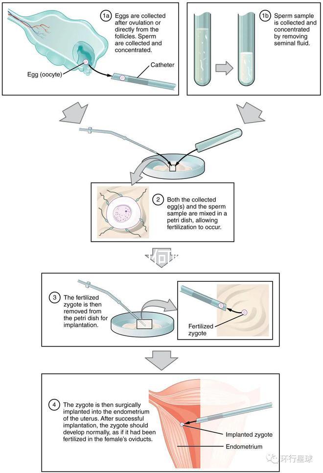 懷孕期間如何降血糖效果更好？