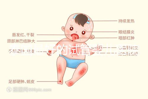 泰國(guó)最好的試管嬰兒醫(yī)院(泰國(guó)最好的試管嬰兒醫(yī)院是哪個(gè))
