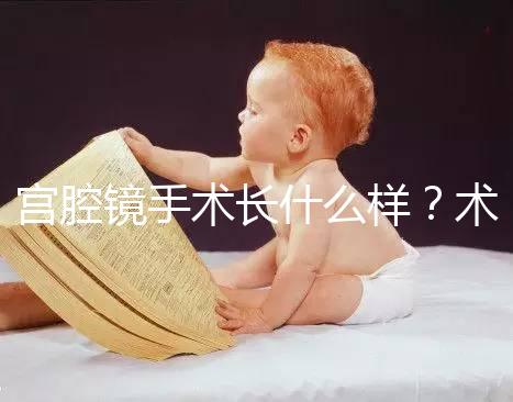 宮腔鏡手術長什么樣？術后要注意什么？ ?