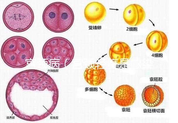 宮頸?。▽m頸輕糜是感染了hpv嗎）