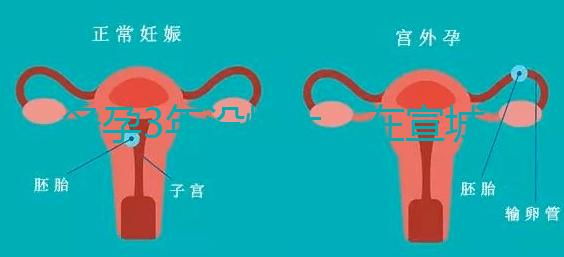 備孕3年沒懷上,在宣城可以做試管嬰兒嗎?