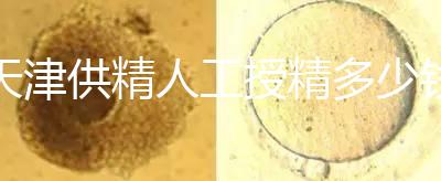 天津供精人工授精多少錢進(jìn)來看，2024年費(fèi)用明細(xì)收集