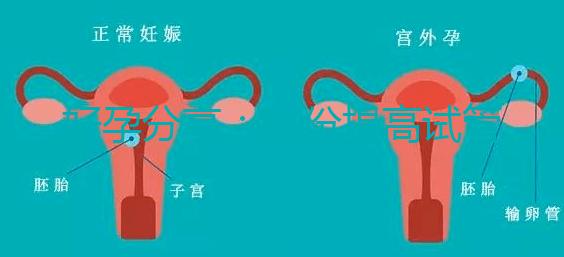 好孕分享：這份提高試管移植著床率的偏方快收藏！全是干貨