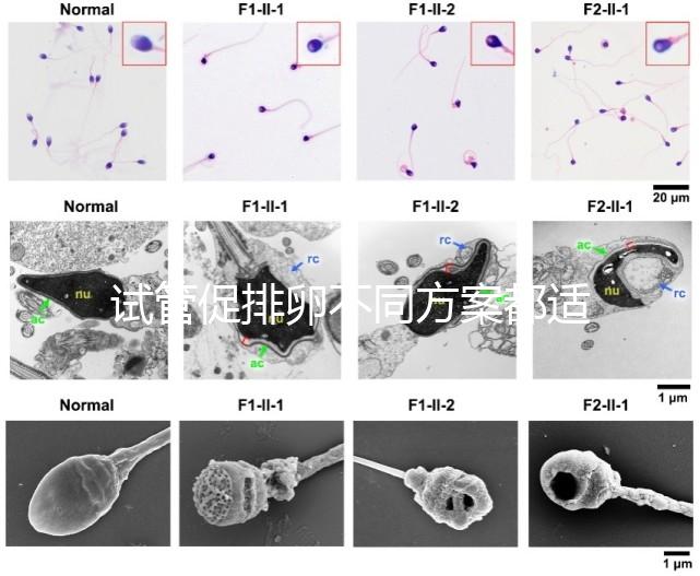試管促排卵不同方案都適合哪些人?如何監(jiān)測排卵?