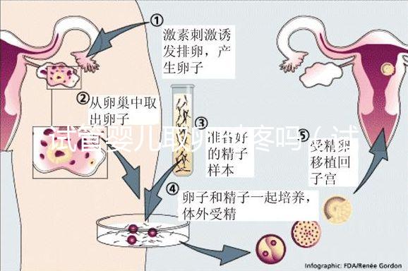 試管嬰兒取卵時疼嗎(試管嬰兒取卵時疼嗎,取卵多長時間才是移植)