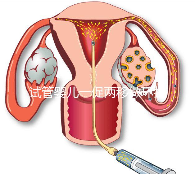 試管嬰兒一促兩移做環扎好看嗎？小心這些影響