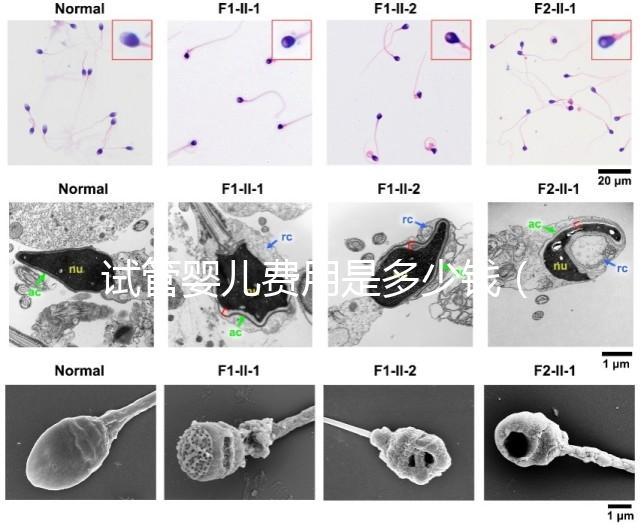 試管嬰兒費用是多少錢（試管嬰兒費用是多少錢一次）