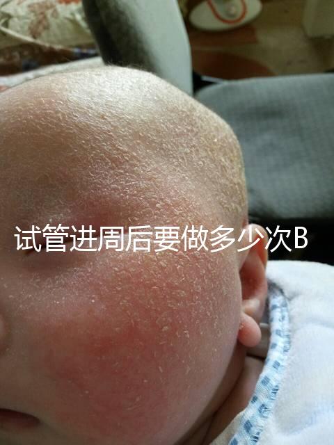 試管進(jìn)周后要做多少次B超?需要檢查什么?進(jìn)來看看