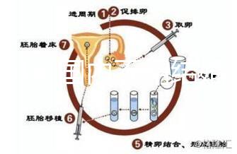 2024年國內不用結婚證做試管嬰兒的醫院排名一覽