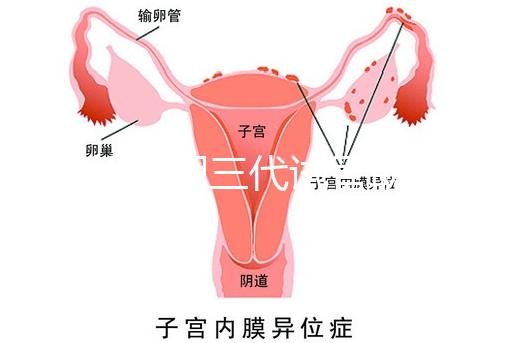 2025昆明三代試管助孕費用一覽,8-15萬元,價格透明公開自主選擇